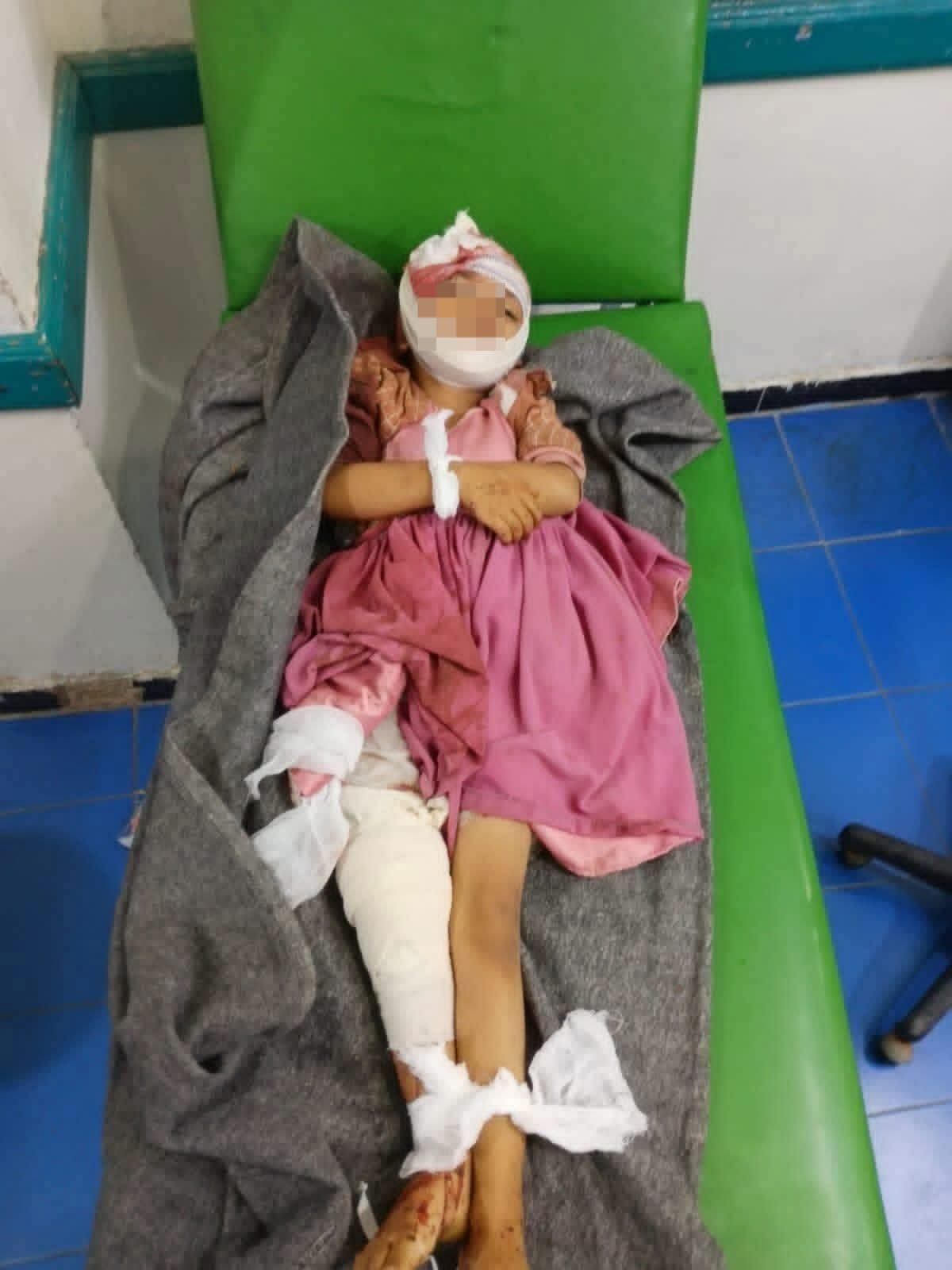 قصف جديد على تعز والعار سيلاحقك للابد ؟!